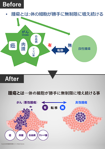 膵臓癌に関する発表のPPTブラッシュアップ